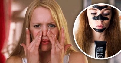 Exprimir los puntos negros tiene consecuencias; ¡podrías terminar en el hospital!