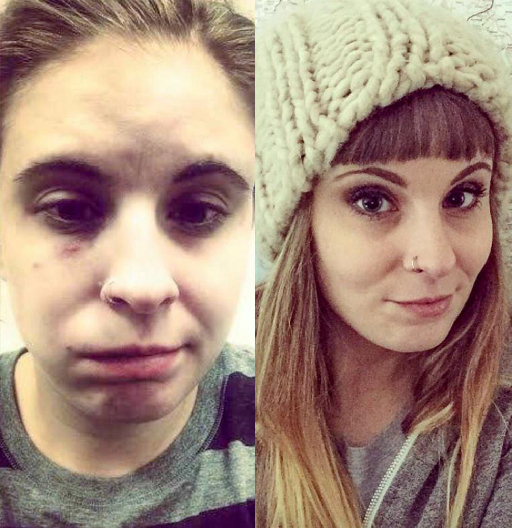 Бросить пить лицо. До и после. Алкоголизм до после внешность. Девушки до и после алкоголизма.