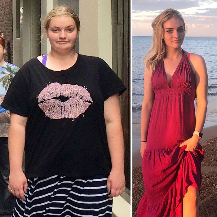 Chica antes y después de perder peso 