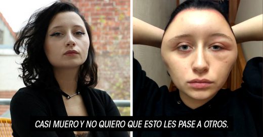 Se tiñó el cabello y su cara sufrió inesperada deformación