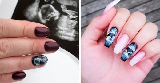 Las uñas ultrasonido están causando furor entre las embarazadas
