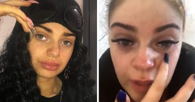 Le colocan pestañas postizas con pegamento para uñas; casi pierde le vista