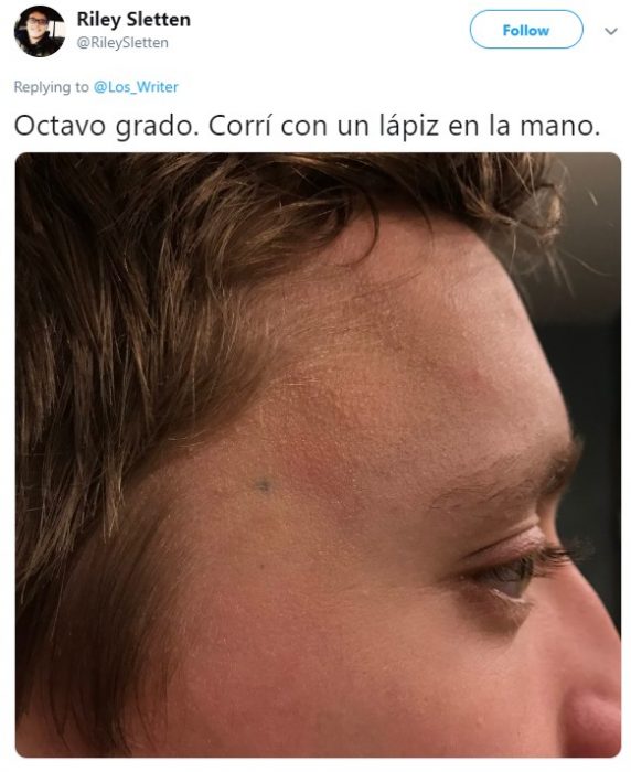 Personas hablan en twitter sobre cómo un pedazo de grafito de lápiz quedó en su piel para siempre