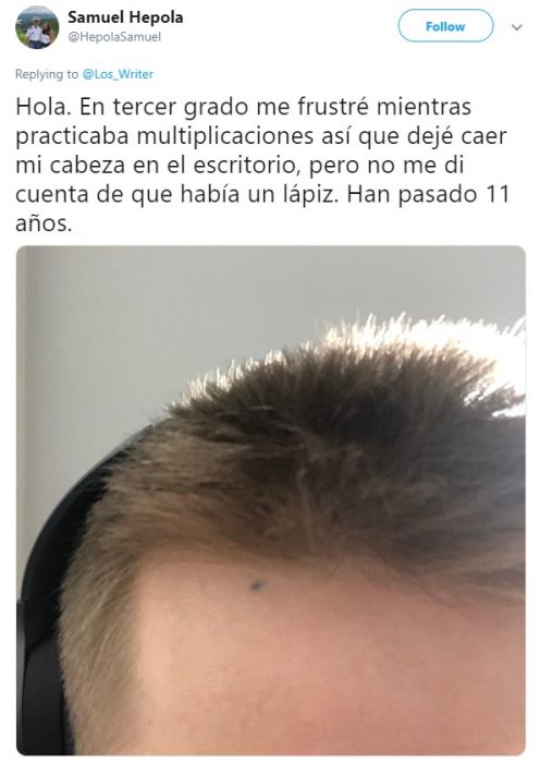 Personas hablan en twitter sobre cómo un pedazo de grafito de lápiz quedó en su piel para siempre