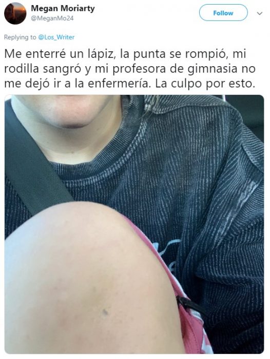 Personas hablan en twitter sobre cómo un pedazo de grafito de lápiz quedó en su piel para siempre