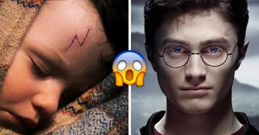Esta teoría afirma que la cicatriz de Harry Potter no es un rayo