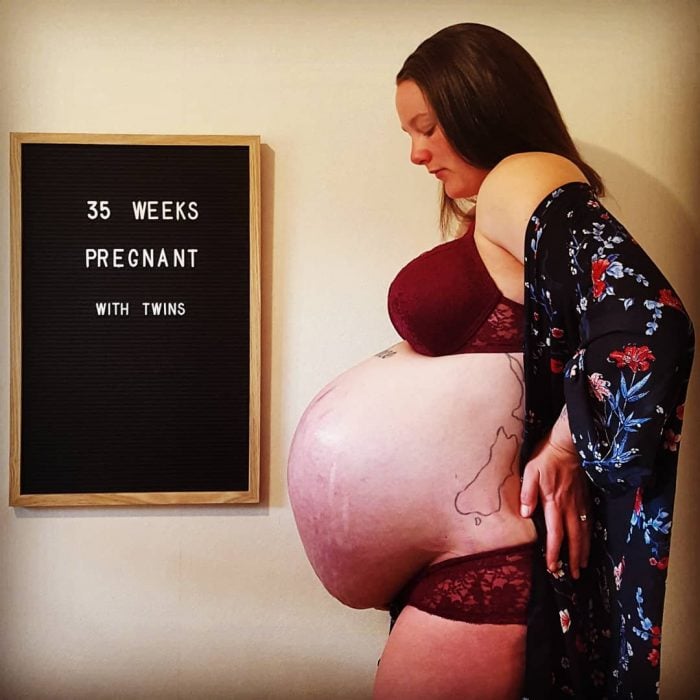 Panzas reales de mujeres embarazadas