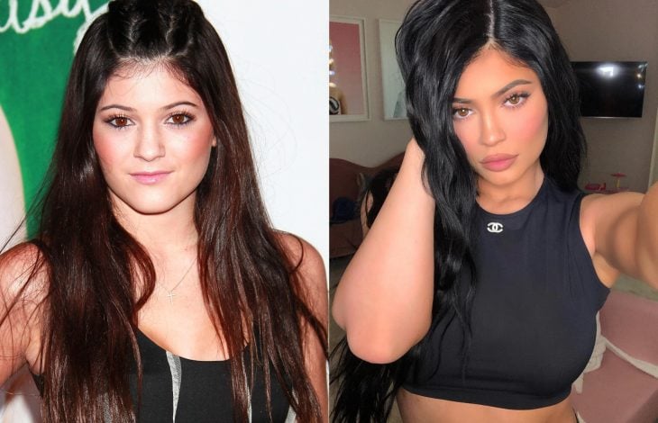 Famosas antes y después, Kylie Jenner