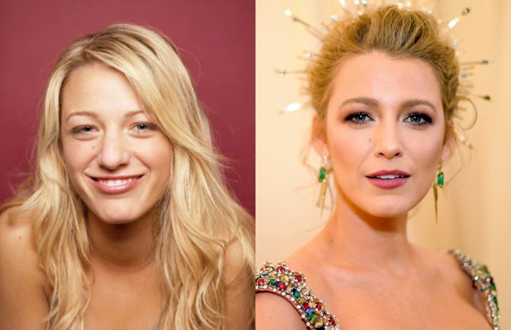 Famosas antes y después, Blake Lively