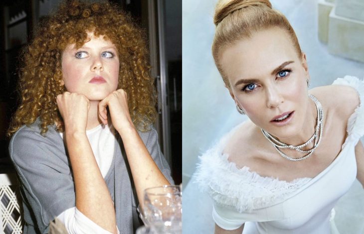 Famosas antes y después, Nicole Kidman