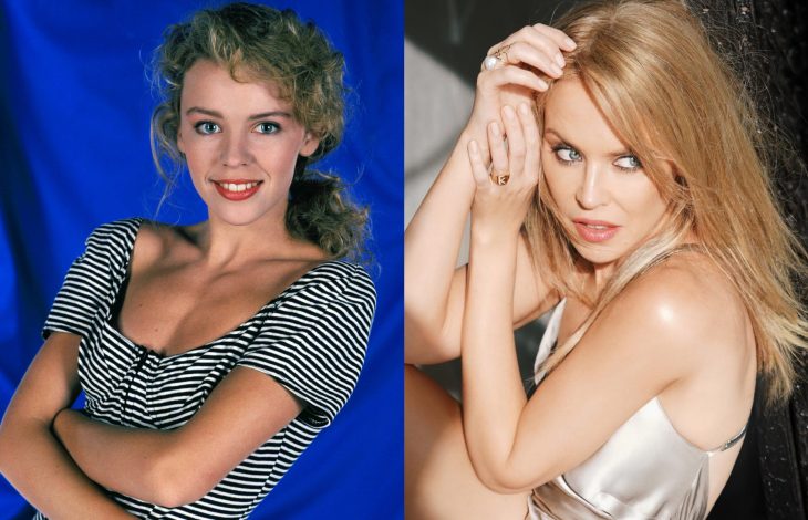Famosas antes y después, Kylie Minogue
