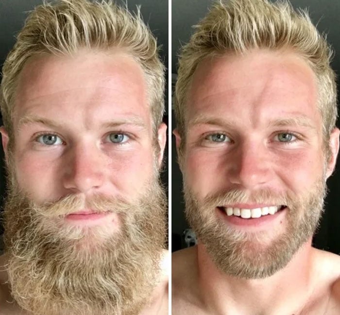 hombres antes y después de sonreír 