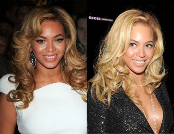 Beyoncé comparación antes y después operaciones