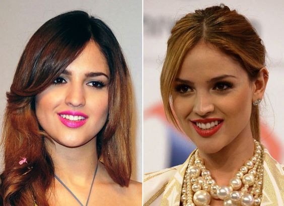 Eiza González result of rhinoplasty before and after