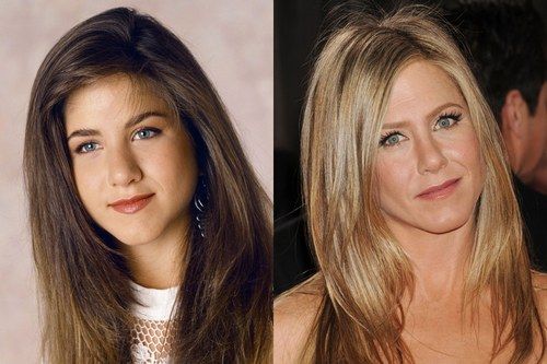 Jennifer Aniston rhinoplasty for many years