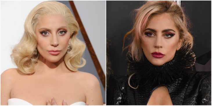 Lady Gaga antes y después de operación