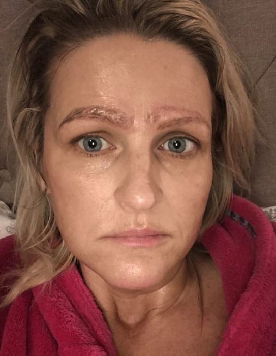 Jami Ledbetter, mujer rubia estadounidense terminó con cuatro cejas después de hacerse un microblading con una estafadora, cejas feas