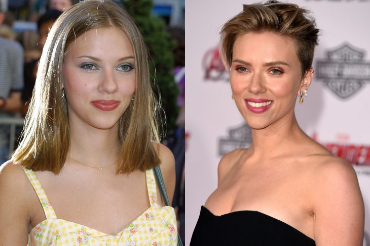 Scarlet Johansson, before and after surgery