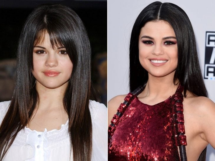 Selena Gomez su cambio por las cirugías