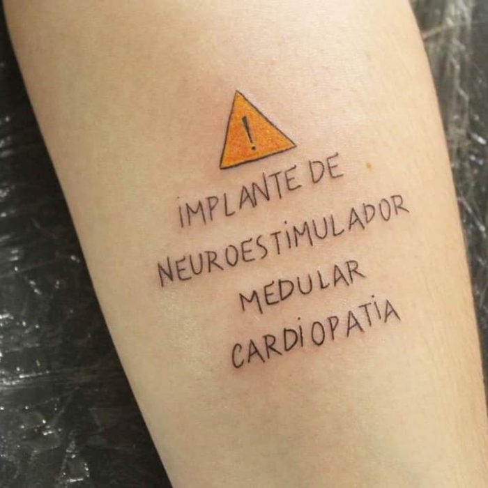 Tatuaje con información médica de un trasplante