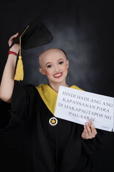 Patricia Banzuela, chica con alopecia, mostrando su condición luego de las fotos de su graduación 