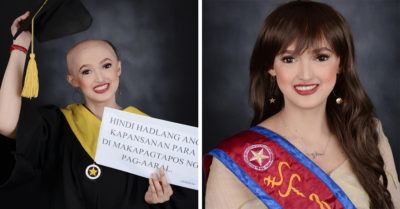 Estudiante muestra con orgullo su alopecia en sus fotos de graduación