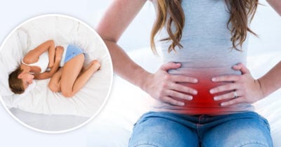 Cáncer de ovario puede confundirse con colitis