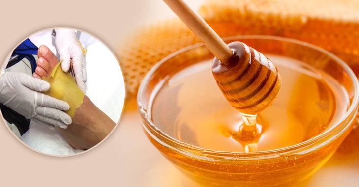 Parche de miel para personas con amputaciones NOTICIA