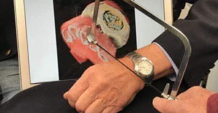 fotografía del escáner de radiografías a color y 3D haciendo un corte de una muñeca con reloj