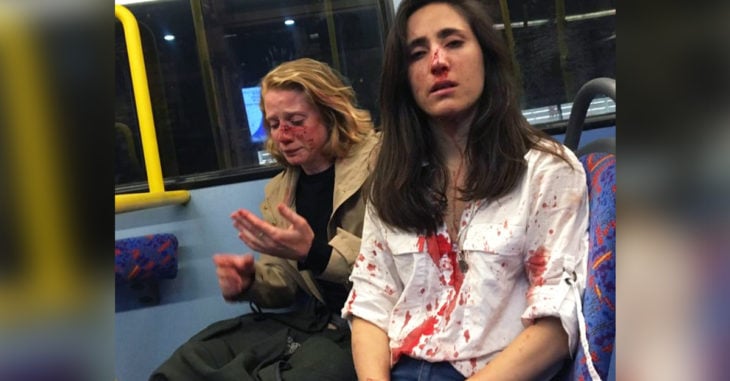 Ataque homofóbico en Londres, golpean a pareja de mujeres tras verlas besarse