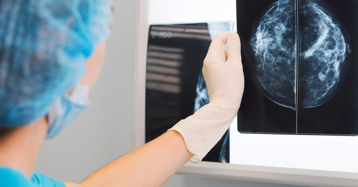 -Inteligencia artificial ayudaría a detectar cáncer de mama