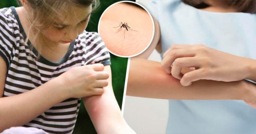 Compuestos químicos en la piel de las personas atraen a los mosquitos