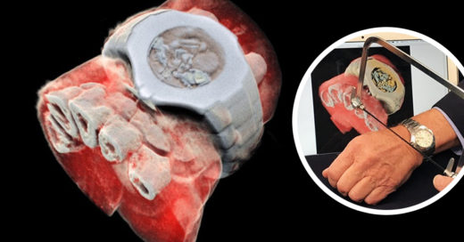 Radiografías a color y 3D el nuevo avance tecnológico para la medicina