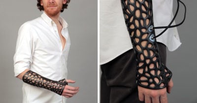 Desarrollan molde médico impreso en 3D para sustituir al tradicional yeso