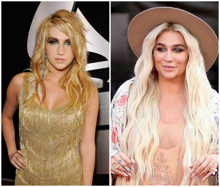 Kesha antes y después de subir de peso drásticamente 