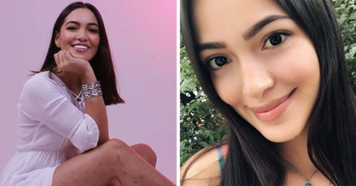 Influencer recibe amenazas por enfermedad en la piel