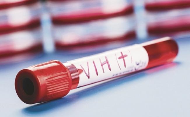 pipeta con sangre en un laboratorio con la leyenda VIH