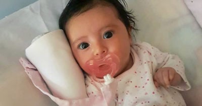 Bebé recibirá el medicamento más caro del mundo gracias a redes sociales