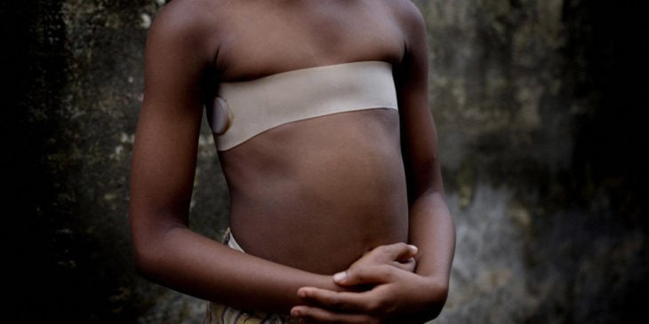 Planchado de senos, tortura a las mujeres de África