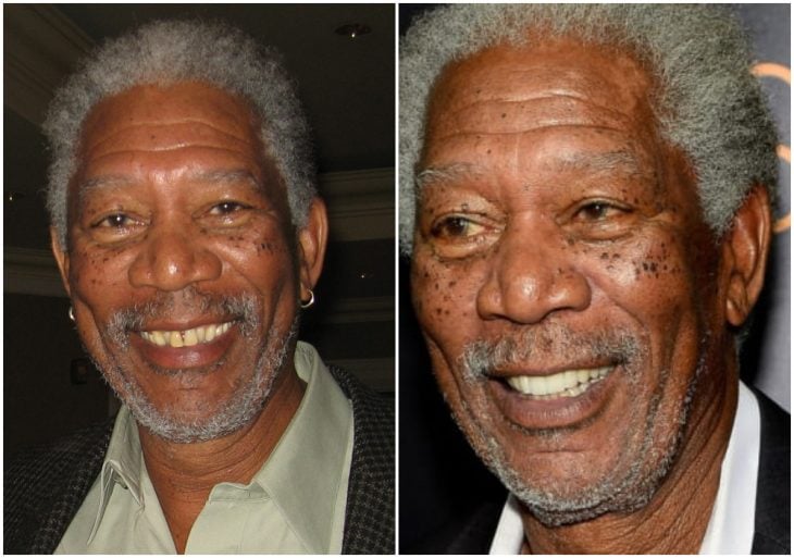 Morgan Freeman antes y después de arreglar su dentadura