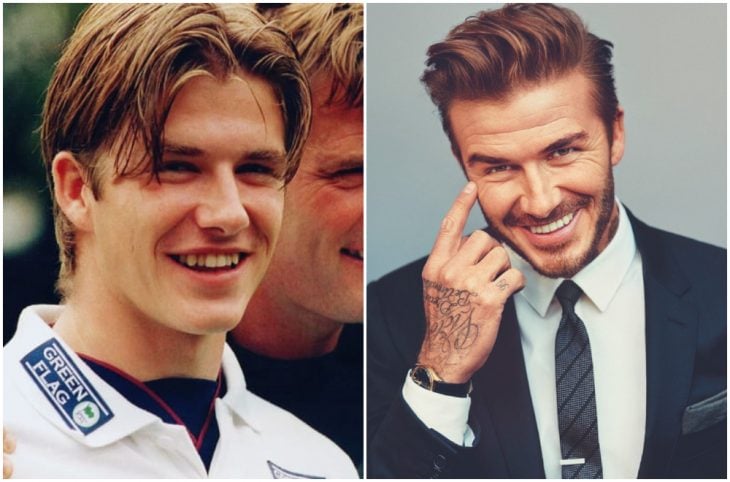 David Beckham antes y después de arreglar su dentadura