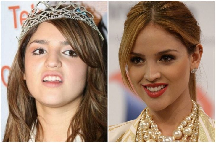 Eiza Gonzalez antes y después de arreglar su dentadura