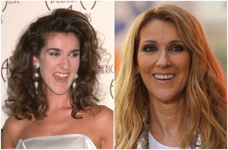 Celine Dion antes y después de arreglar su dentadura