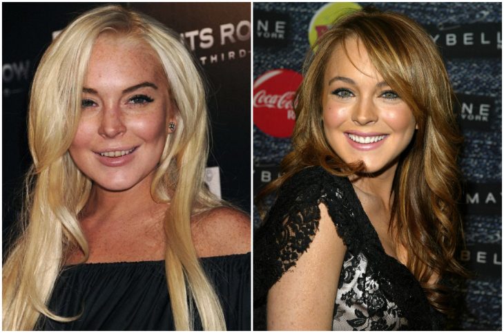 Lindsay Lohan antes y después de arreglar su dentadura