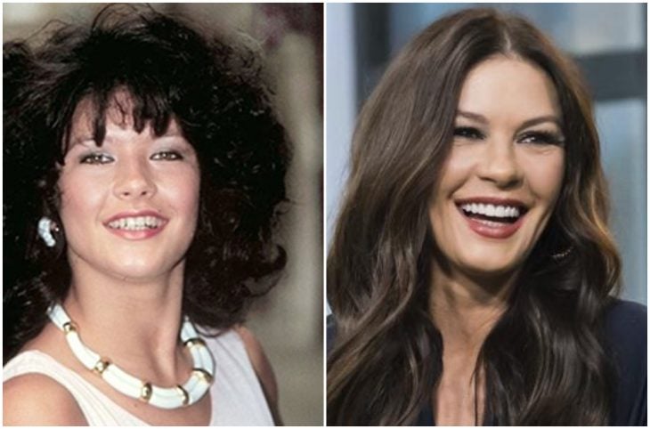 Catherine Zeta Jones antes y después de arreglar su dentadura