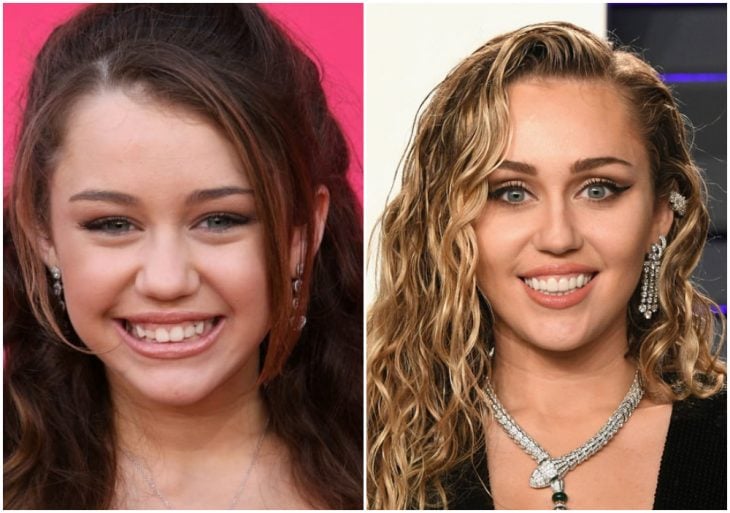 Miley Cyrus antes y después de arreglar su dentadura