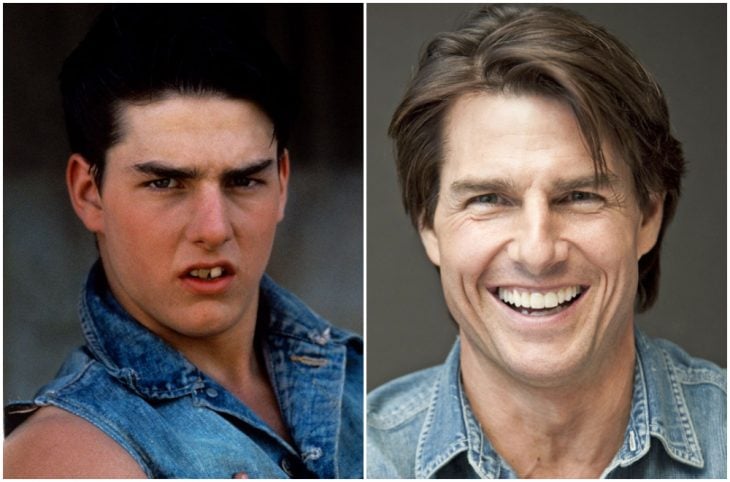 Tom Cruise antes y después de arreglar su dentadura