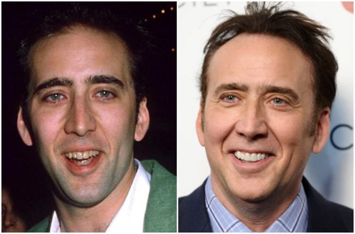 Nicolas Cage antes y después de arreglar su dentadura