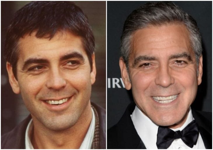 George Clooney antes y después de arreglar su dentadura