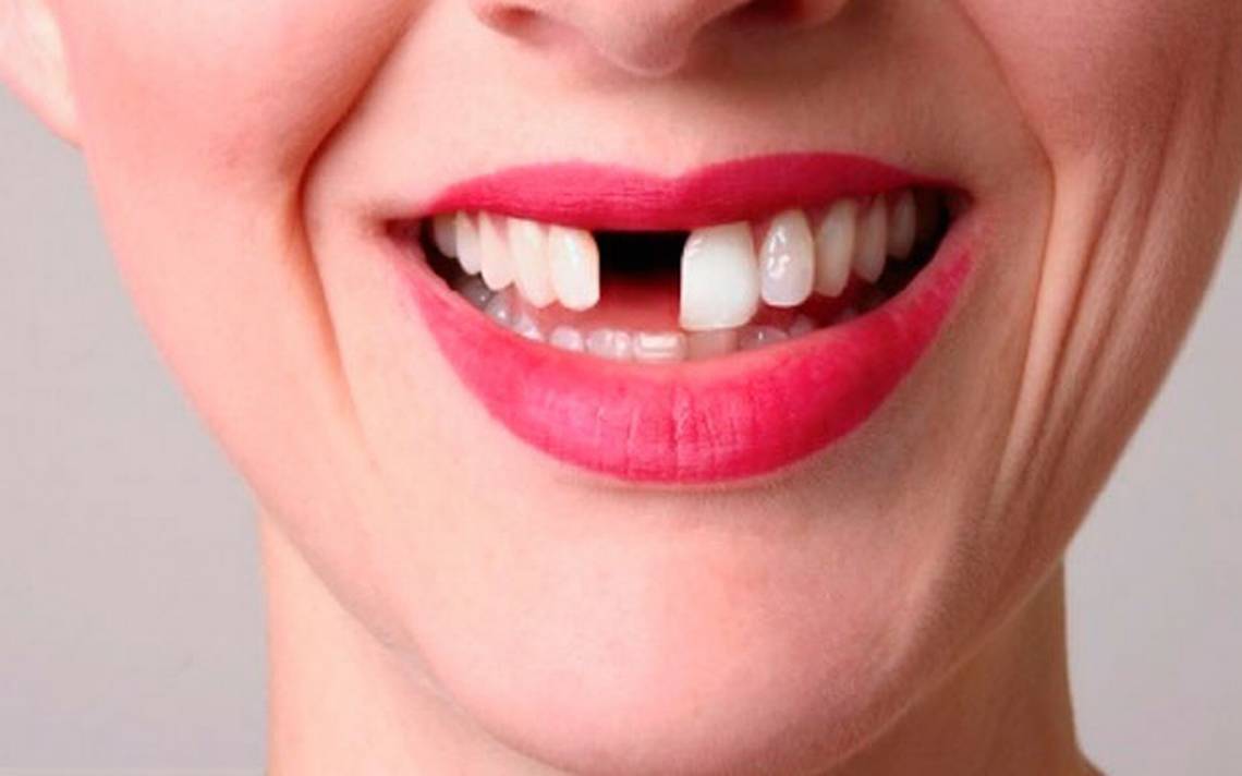 intencional archivo sábado Técnica con células madre puede hacer crecer nuevos dientes